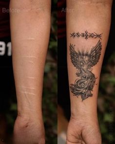 SCAR COVER-UP example 2