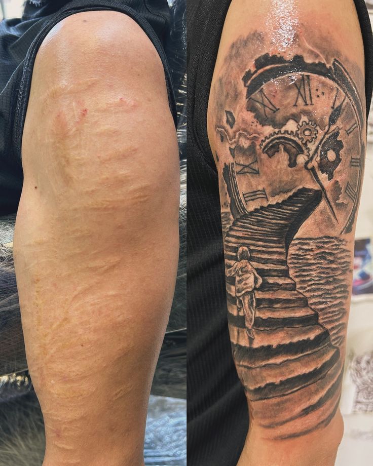 SCAR COVER-UP example 5