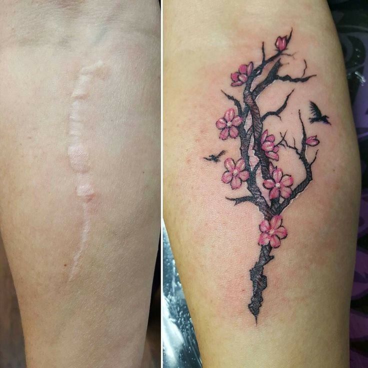 SCAR COVER-UP example 6